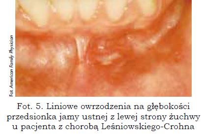 Гиперпигментация слизистой оболочки полости рта (например, при болезни Аддисона) может быть первым неспецифическим симптомом заболевания, поэтому многие другие диагнозы следует учитывать при дифференциальной диагностике (например, пигментация из-за этнической принадлежности, табачная или лекарственная пигментация, нейрофиброматоз типа 1, синдром) Маккун и Олбрайт   и   , Группа Peutz и Jaghers   II   )