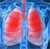 Запальні захворювання дихальної системи   - Дихальна система складається з дихальних шляхів, по яких переміщається повітря (порожнину носа, гортань, трахея), і з легких