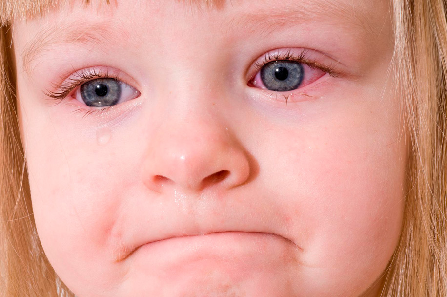 підвищення тиску через старань немовляти при проходженні родових шляхів;   недосвідченість медичного персоналу;   тривалі і складні пологи;   застосування окситоцину і подібних препаратів для стимуляції пологів;   сильний плач немовляти