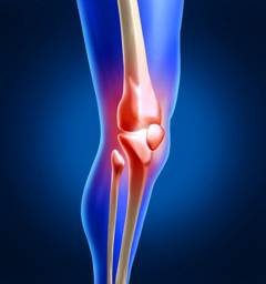 Ендопротезування колінного суглоба - одна з найбільш затребуваних ортопедичних послуг