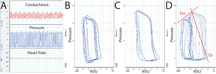 Малюнок 7: Аналіз правого шлуночка тиску обсяг петлі (A) Канали в програмне забезпечення для демонстрації провідності (RVU - відносні одиниці об'єму), RV тиску (мм рт