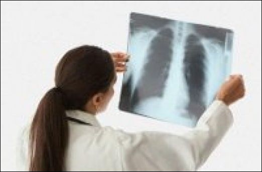 Лікування запалення легенів народними засобами