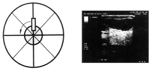 Для порівнянності одержуваних результатів вимірювання цих показників проводилися при однаковій налаштування апарату: глибина сканування - 5 см, посилення (Gain) - 66, динамічний діапазон (Dynamic Range) - 72
