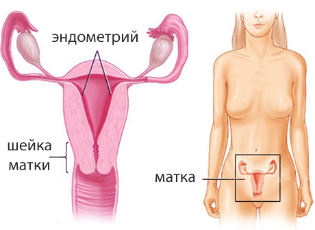 Близько 10% жінок, хворих на рак яєчників, мають обтяжений анамнез по «сімейному раковому синдрому» (сімейний синдром «рак молочної залози - яєчники»)