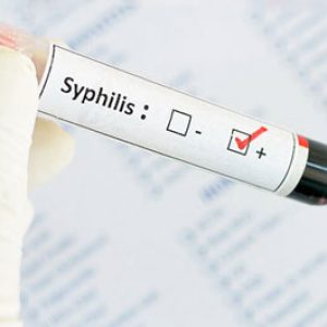 Діагностика вторинного сифілісу складається з широкого кола шкірних захворювань і гострих інфекцій