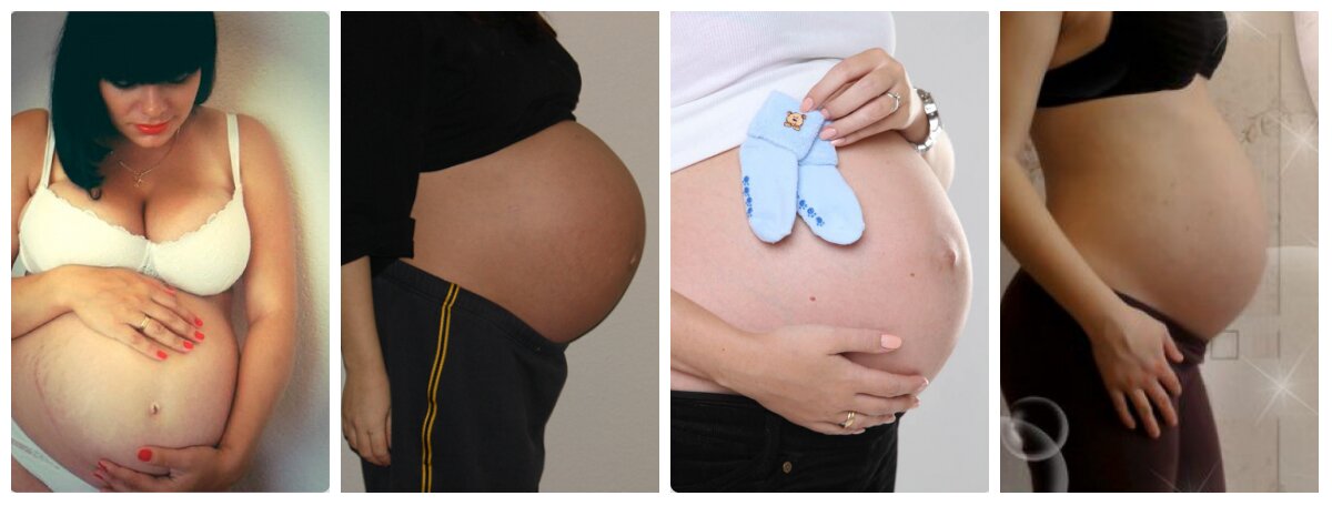 Виглядають животики на 35 тижні вагітності так: