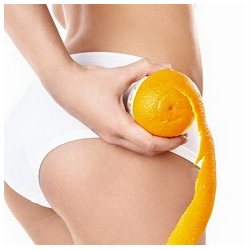 Целюліт - це стан шкіри, при якому накопичився підшкірний жир проявляється у вигляді естетичних нерівностей і зовні схожий на апельсинову кірку