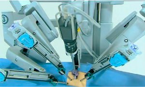 За останні роки ендоскопічні техніки проведення операцій перестали бути інноваціями і увійшли в повсякденне життя хірургії