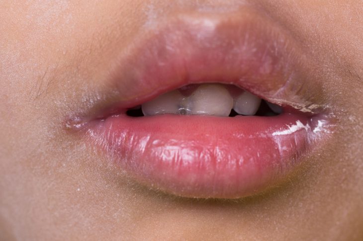 Червона облямівка зовні і слизова оболонка губ з боку порожнини рота мають дещо різне будова, стійкість до дії несприятливих чинників і властивості