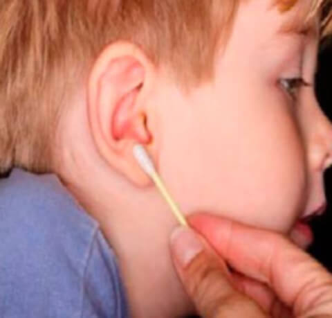 Серед інших захворювань вух часто зустрічаються:
