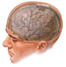 Енцефалопатія є наслідком перенесених травм і супутніх захворювань головного мозку