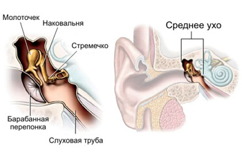 У нормі тиск в порожнині середнього вуха дорівнює атмосферному