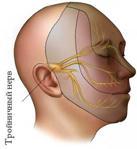 Що таке невралгія трійчастого нерва