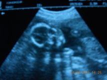 Знімки УЗД на 41 тижні розвитку вагітності