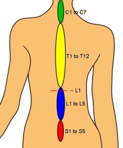 Метою поперекового спондилодезу є усунення болю при русі, що виникає в нижній частині спини