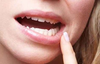 Неприємна ситуація: ниючий біль, почервоніння, набухання м'яких тканин, іноді навіть кровоточивість - все це не дає в повній мірі радіти життю, та ще й може привести до розвитку більш серйозних захворювань ротової порожнини