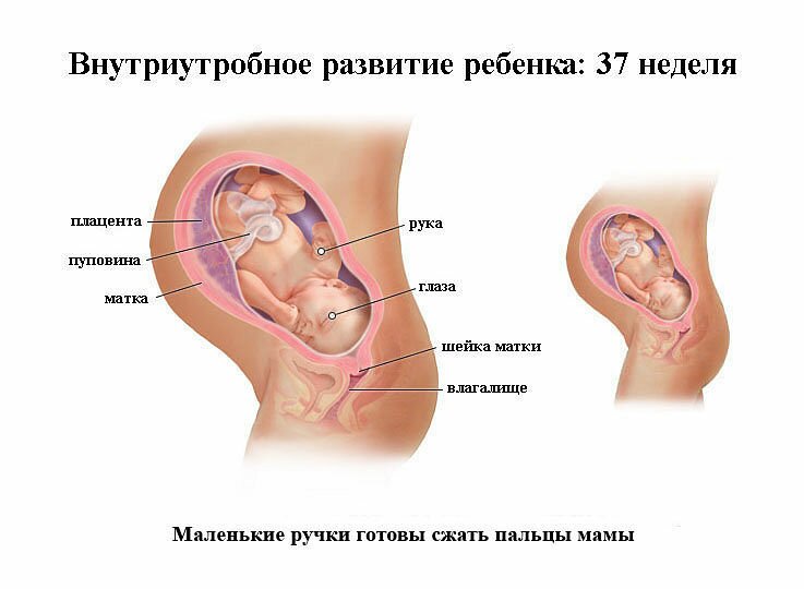 Тому цілком логічно, якщо у високих батьків малюк буде крупніше своїх однолітків на момент народження, а у низьких - відповідно, менше