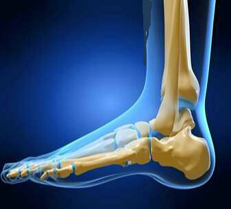 Одна п'ята всіх випадків травм ноги доводиться на перелом щиколотки без зміщення