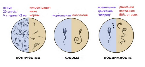 спермограма