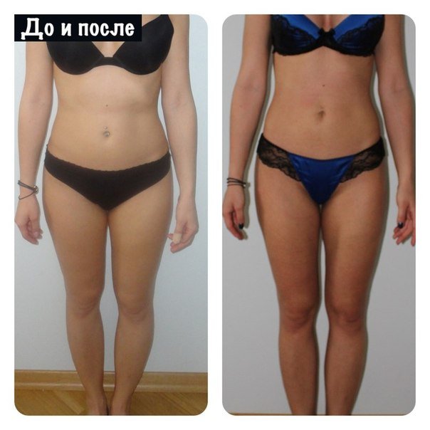 Результати даного масажу добре помітні на фото до і після: