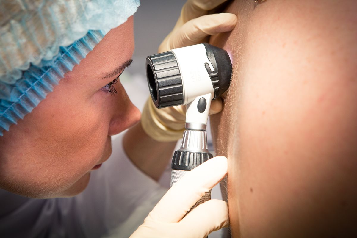 Базальноклітинний рак шкіри (також відомий як базаліома або базальноклітинний карцинома) - найбільш поширена злоякісна форма раку шкіри у людини