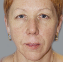 Матеріал з фотоархіву компанії «Валлекс М»