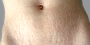 Фотографії без ретуші, надані ТОВ «Валлекс М»