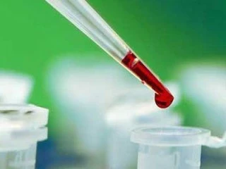 Але, як відомо, не завжди зміст цього гормону у жінки в нормі