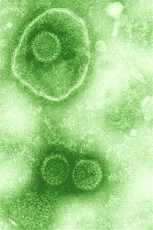 Далеко не кожен знає, що практично будь-яка людина - потенційний носій вірусу герпесу