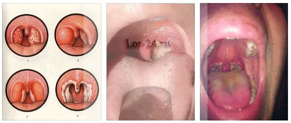 до змісту ↑