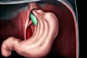 Коли нижня частина стравоходу, шлунка або кишкові петлі зміщуються в грудне отвір діафрагми, діагностують грижу