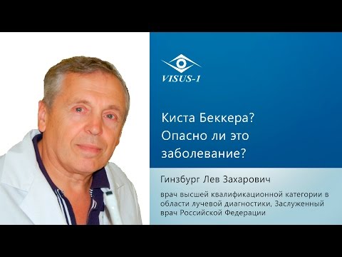 Кіста Беккера