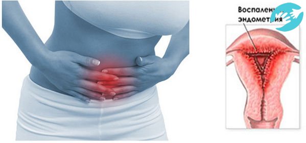 Будь-яку хворобу слід пролікувати якомога раніше, щоб не трапилися неприємні наслідки