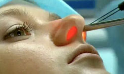 ЛОР-лікар - це професіонал, який займається діагностикою, лікуванням, а також профілактикою патологій вух і носоглотки (вухо горло ніс)