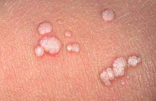 Це виникає від впливу сонячних променів, а також обумовлено спадковістю