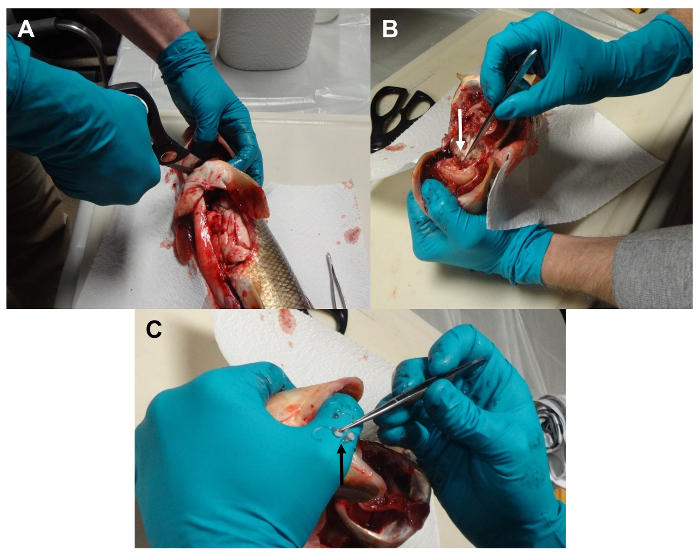 Малюнок 5: Видалення отоліти
