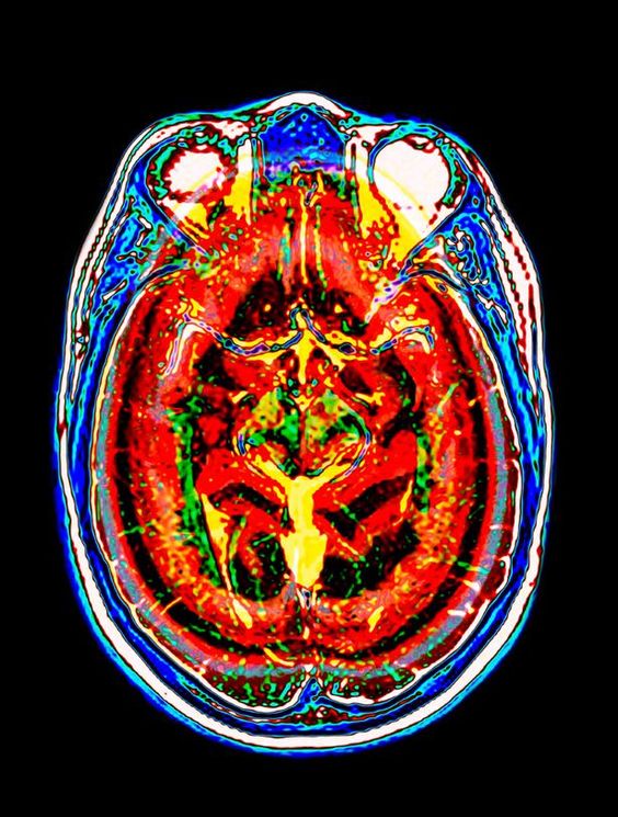 Людям з фобіями замкнутих приміщень потрібно попередньо повідомити фахівця про страхи