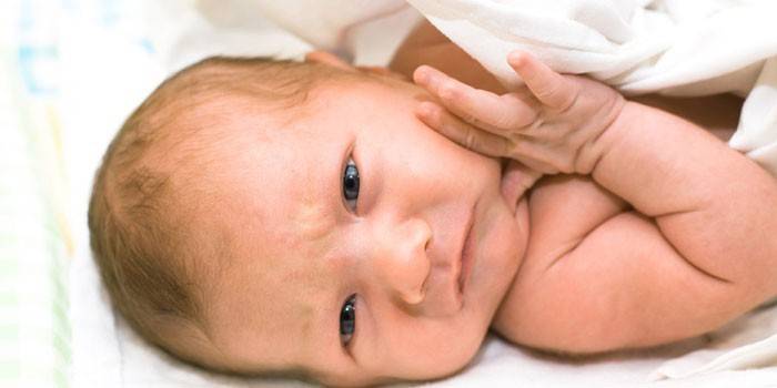 пневмонія;   анурія;   гипоксическое ураження головного мозку;   кишковий дисбактеріоз;   поганий розвиток внутрішніх органів або його відсутність;   ниркова кома;   ниркова недостатність аж до відмови нирок;   рахіт;   залозодефіцитна анемія;