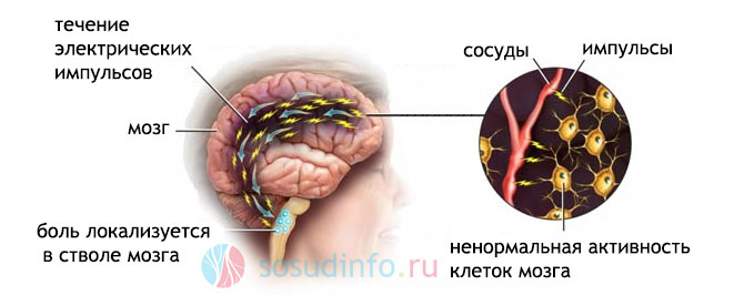 У здорових ці реакції йдуть не так стрімко, тонус судин головного мозку відновлюється плавно, нервові закінчення не порушуються, все проходить безболісно