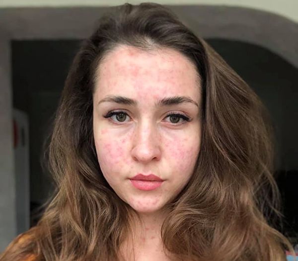 Власним сумним досвідом поділилася киянка Олена Кудряшова на своїй сторінці в Facebook