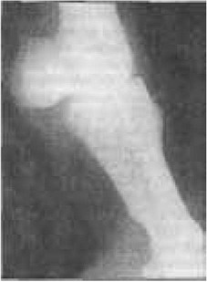 В результаті сильного навантаження на путового кістка виникають, в основному в місцях прикріплення капсули путового суглоба, сухожиль і зв'язок, запалення окістя з кістковими наростами