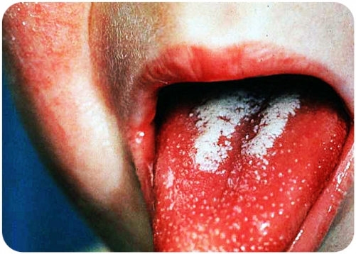 Часом це робиться тільки на основі відповідних аналізів