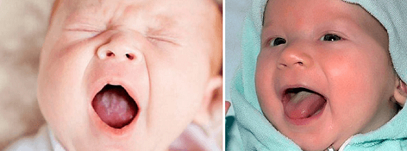 Висип у роті при стоматиті