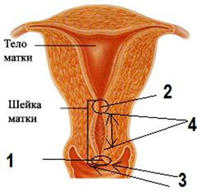 Вартість лікування ерозії шийки матки методом аргоноплазменной абляції становить 2000 гривень