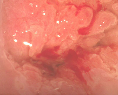 Це доведений клінічно факт