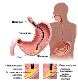 +   збільшити