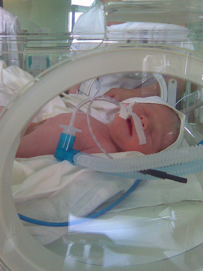 Тим часом, стан моєї Кристиночки стабілізували, і операцію їй зробили 5го липня