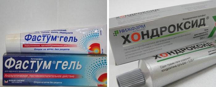 Місцеві засоби: гелі та мазі