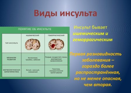 різновиди інсульту