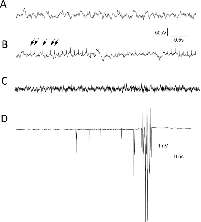A) Intrahippocampal EEG запис з контрольною миші
